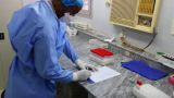 Нет антидотов: чем опасны штаммы, изучавшиеся в биолаборатории в Судане