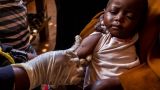 Пандемия Covid-19 вызвала в бедных странах рост заболеваемости корью — ВОЗ