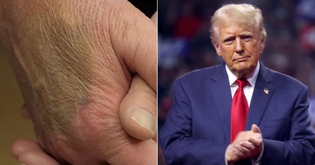 Трамп рассказал о своем здоровье