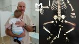 Московские врачи спасли ребенка, родившегося с тремя ногами