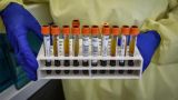 В Италии создали вакцину, нейтрализующую коронавирус