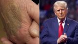Трамп рассказал о своем здоровье