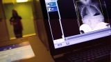 В Германии создали «линзу» для долгих рентгеновских наблюдений за организмами